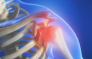shoulder-pain dolor de hombro